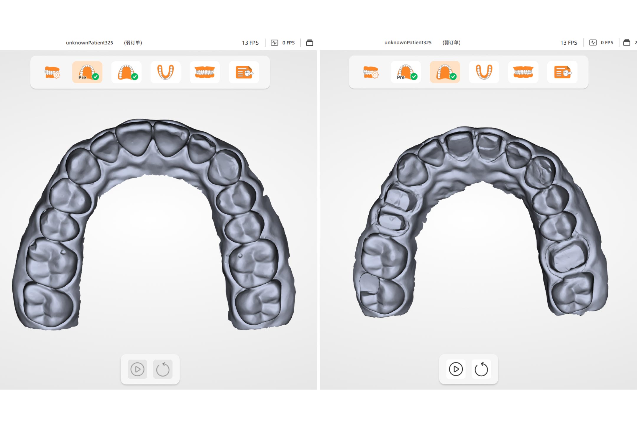 Pre-operative Oral Scan